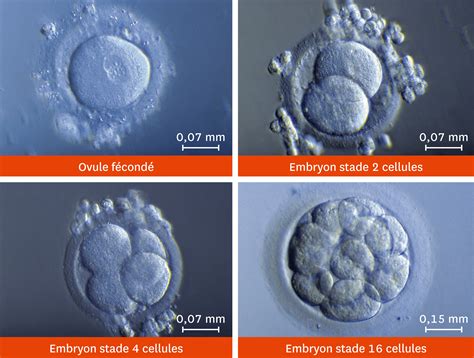 rencontre ovule spermatozoïdes|Stades du développement fœtal